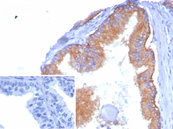 Formalin-fixed, paraffin-embedded human tonsil stained with CD38 antibody (rCD38/8334) - Azide and BSA Free. Inset: PBS instead of primary antibody; secondary only negative control.