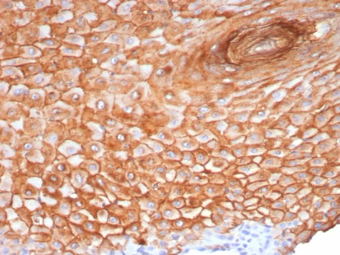 Immunohistochemistry-Paraffin: SBSN Antibody (SBSN/7965) - Azide and BSA Free [NBP3-23984] - Formalin-fixed, paraffin-embedded human skin stained with SBSN Antibody (SBSN/7965). HIER: Tris/EDTA, pH9.0, 45min. 2°C: HRP-polymer, 30min. DAB, 5min.