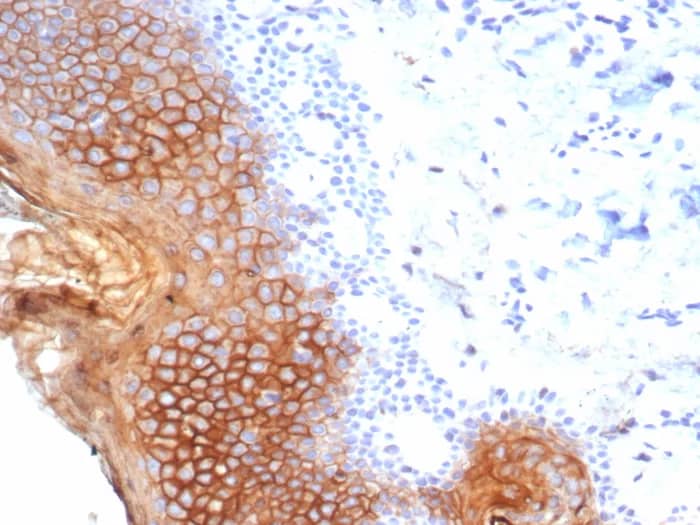 Immunohistochemistry-Paraffin: SBSN Antibody (SBSN/7965) - Azide and BSA Free [NBP3-23984] - Formalin-fixed, paraffin-embedded human esophagus stained with SBSN Antibody (SBSN/7965). HIER: Tris/EDTA, pH9.0, 45min. 2°C: HRP-polymer, 30min. DAB, 5min.