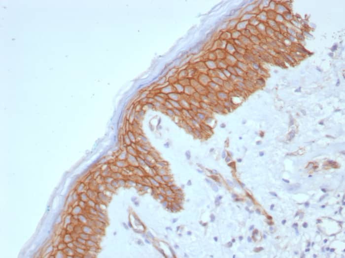 Formalin-fixed, paraffin-embedded human skin stained with beta-Catenin antibody (CTNNB1/8280R) - Azide and BSA Free. HIER: Tris/EDTA, pH9.0, 45min. Secondary: HRP-polymer, 30min. DAB, 5min.