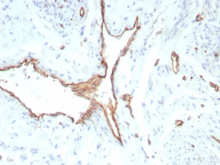Immunohistochemistry-Paraffin: CD31/PECAM-1 Antibody (rPECAM1/8829) - Azide and BSA Free [NBP3-23988] - Formalin-fixed, paraffin-embedded human uterus stained with CD31/PECAM-1 Antibody (rPECAM1/8829). HIER: Tris/EDTA, pH9.0, 45min. 2°C: HRP-polymer, 30min. DAB, 5min.