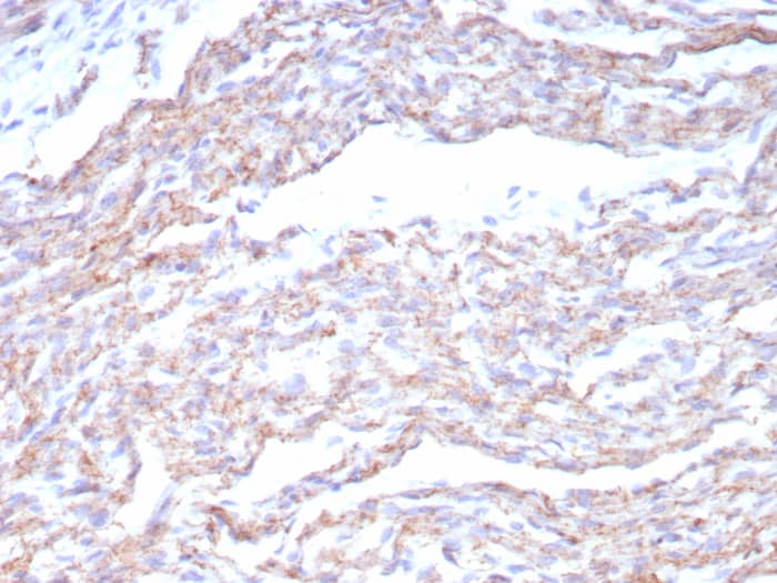 Formalin-fixed, paraffin-embedded human heart stained with N-Cadherin antibody (CDH2/8815R) - Azide and BSA Free. HIER: Tris/EDTA, pH9.0, 45min. Secondary: HRP-polymer, 30min. DAB, 5min.