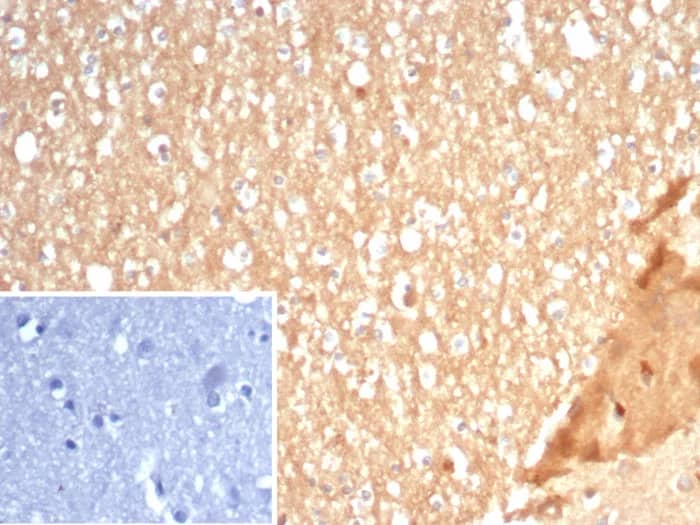 Immunohistochemistry-Paraffin: S100A5 Antibody (S100A5/7472) - Azide and BSA Free [NBP3-23994] - Formalin-fixed, paraffin-embedded human brain stained with S100A5 Antibody (S100A5/7472). Inset: PBS instead of primary antibody; secondary only negative control.