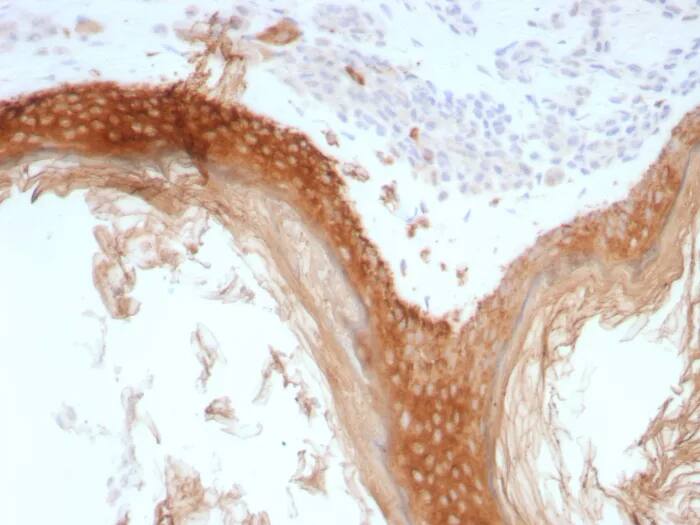 Immunohistochemistry-Paraffin: Cytokeratin, HMW Antibody (rKRTH/8883) - Azide and BSA Free [NBP3-24000] - Formalin-fixed, paraffin-embedded human skin stained with Cytokeratin, HMW Antibody (rKRTH/8883). HIER: Tris/EDTA, pH9.0, 45min. 2°C: HRP-polymer, 30min. DAB, 5min.