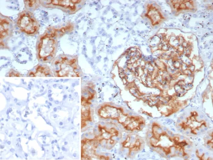 Immunohistochemistry-Paraffin: Neprilysin/CD10 Antibody (rMME/9377) - Azide and BSA Free [NBP3-24004] - Formalin-fixed, paraffin-embedded human prostate stained with Neprilysin/CD10 Antibody (rMME/9377). HIER: Tris/EDTA, pH9.0, 45min. 2°C: HRP-polymer, 30min. DAB, 5min.