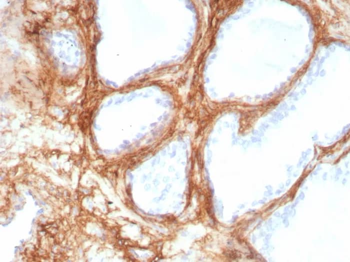 Immunohistochemistry-Paraffin: Periostin/OSF-2 Antibody (POSTN/8951R) - Azide and BSA Free [NBP3-24005] - Formalin-fixed, paraffin-embedded human lung stained with Periostin/OSF-2 Antibody (POSTN/8951R). HIER: Tris/EDTA, pH9.0, 45min. 2°C: HRP-polymer, 30min. DAB, 5min.