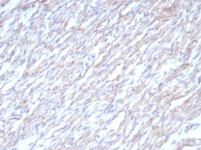 Immunohistochemistry-Paraffin: N-Cadherin Antibody (CDH2/8862R) - Azide and BSA Free [NBP3-24009] - Formalin-fixed, paraffin-embedded human heart stained with N-Cadherin Antibody (CDH2/8862R). HIER: Tris/EDTA, pH9.0, 45min. 2°C: HRP-polymer, 30min. DAB, 5min.