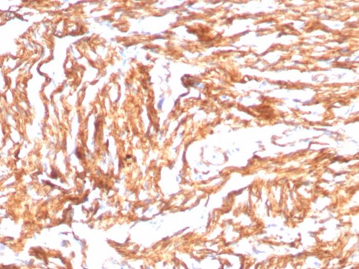 Immunohistochemistry-Paraffin: N-Cadherin Antibody (CDH2/8998R) - Azide and BSA Free [NBP3-24010] - Formalin-fixed, paraffin-embedded human heart stained with N-Cadherin Antibody (CDH2/8998R). HIER: Tris/EDTA, pH9.0, 45min. 2°C: HRP-polymer, 30min. DAB, 5min.