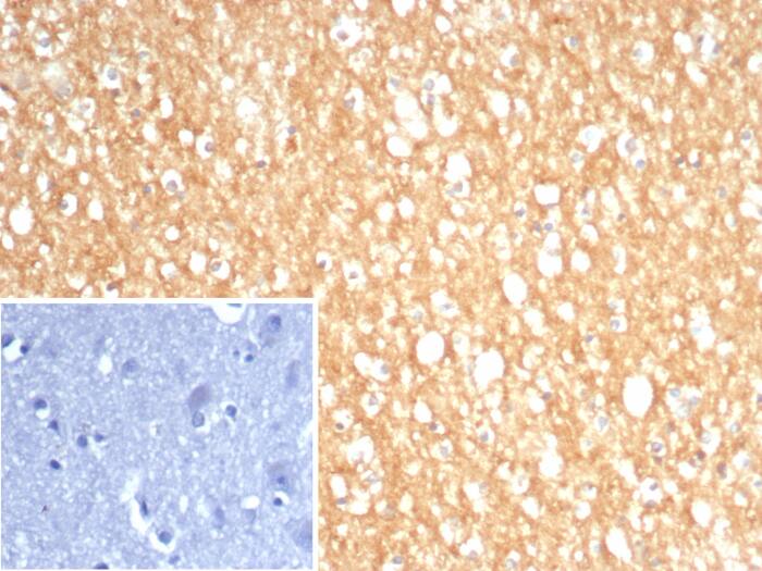 Formalin-fixed, paraffin-embedded human brain stained with S100A5 antibody (S100A5/7474) - Azide and BSA Free. Inset: PBS instead of primary antibody; secondary only negative control.
