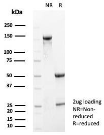 Formalin-fixed, paraffin-embedded human brain stained with S100A5 antibody (S100A5/7474) - Azide and BSA Free. Inset: PBS instead of primary antibody; secondary only negative control.