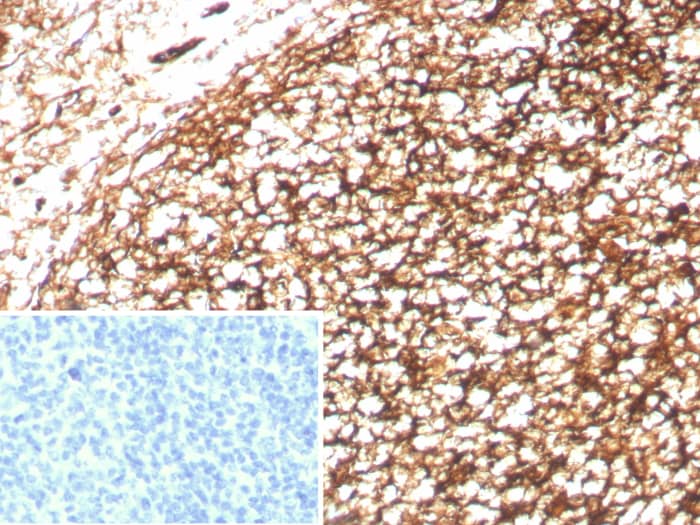 Formalin-fixed, paraffin-embedded human tonsil stained with CD35 antibody (CR1/8833R) - Azide and BSA Free. Inset: PBS instead of primary antibody; secondary only negative control.