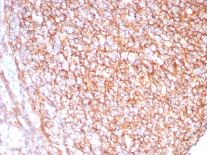 Formalin-fixed, paraffin-embedded human tonsil stained with CD21 antibody (CR2/8880R) - Azide and BSA Free. HIER: Tris/EDTA, pH9.0, 45min. Secondary: HRP-polymer, 30min. DAB, 5min.