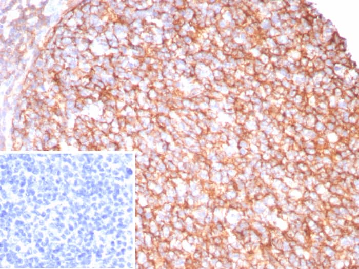 Formalin-fixed, paraffin-embedded human tonsil stained with CD21 antibody (CR2/8880R) - Azide and BSA Free. Inset: PBS instead of primary antibody; secondary only negative control.