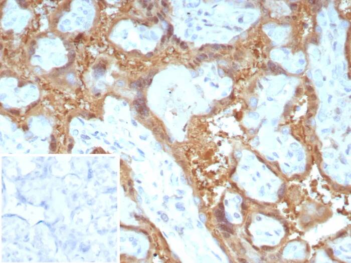 Immunohistochemistry-Paraffin: Galectin 13 Antibody (PP13/8897) - Azide and BSA Free [NBP3-24020] - Formalin-fixed, paraffin-embedded human placenta stained with Galectin 13 Antibody (PP13/8897). Inset: PBS instead of primary antibody; secondary only negative control.