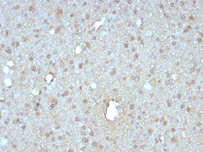 Formalin-fixed, paraffin-embedded human pancreas stained with GIRK2 antibody (KCNJ6/7558) - Azide and BSA Free at 2ug/ml. HIER: Tris/EDTA, pH9.0, 45min. Secondary: HRP-polymer, 30min. DAB, 5min.