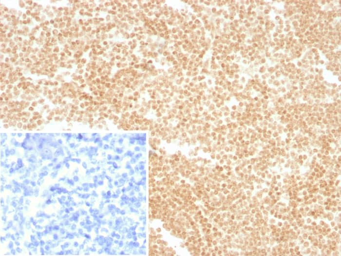 Formalin-fixed, paraffin-embedded human tonsil stained with LDB2 antibody (PCRP-LDB2-1B10) - Azide and BSA Free. Inset: PBS instead of primary antibody; secondary only negative control.