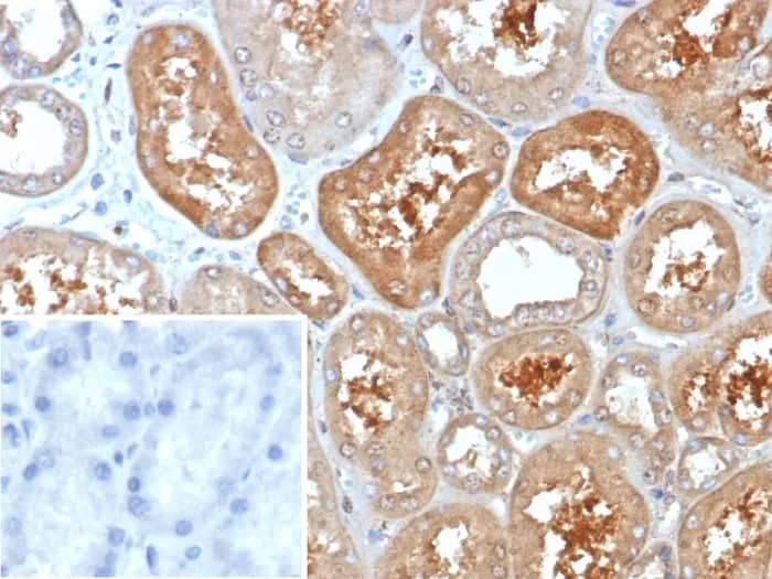 Immunohistochemistry-Paraffin: KChIP2 Antibody (KCNIP2/7588) - Azide and BSA Free [NBP3-24038] - Formalin-fixed, paraffin-embedded human kidney stained with KChIP2 Antibody (KCNIP2/7588). Inset: PBS instead of primary antibody; secondary only negative control.