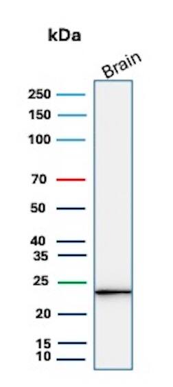 Western Blot Analysis of human brain tissue lysate using UCH-L1/PGP9.5 Antibody (rUCHL1/8057) - Azide and BSA Free. 