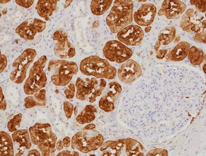 Immunohistochemistry-Paraffin: FABP1/L-FABP Antibody (FABP1/9085R) - Azide and BSA Free [NBP3-24046] - Formalin-fixed, paraffin-embedded human kidney stained with FABP1/L-FABP Antibody (FABP1/9085R). Inset: PBS instead of primary antibody; secondary only negative control.