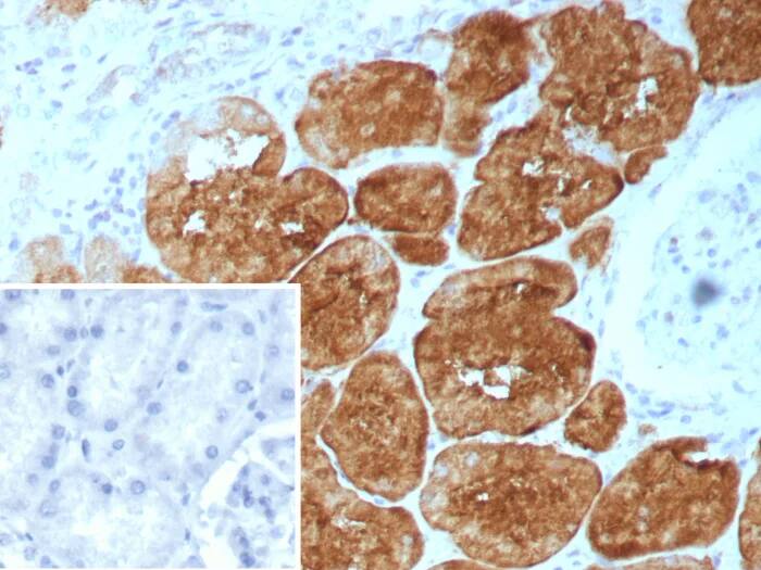 Immunohistochemistry-Paraffin: FABP1/L-FABP Antibody (FABP1/9085R) - Azide and BSA Free [NBP3-24046] - Formalin-fixed, paraffin-embedded human kidney stained with FABP1/L-FABP Antibody (FABP1/9085R). HIER: Tris/EDTA, pH9.0, 45min. 2°C: HRP-polymer, 30min. DAB, 5min.