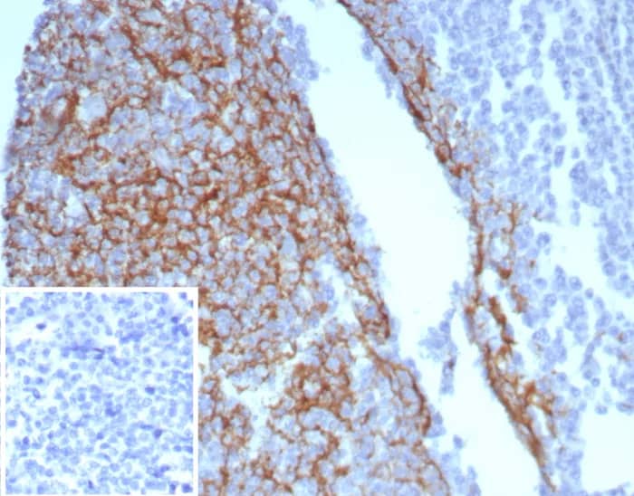 Immunohistochemistry-Paraffin: CD23/Fc epsilon RII Antibody (FCER2/8234R) - Azide and BSA Free [NBP3-24047] - Formalin-fixed, paraffin-embedded human tonsil stained with CD23/Fc epsilon RII Antibody (FCER2/8234R). Inset: PBS instead of primary antibody; secondary only negative control.