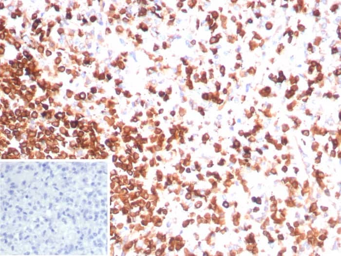 Immunohistochemistry-Paraffin: CD3 epsilon Antibody (rC3e/8881) - Azide and BSA Free [NBP3-24048] - Formalin-fixed, paraffin-embedded human spleen stained with CD3 epsilon Antibody (rC3e/8881). Inset: PBS instead of primary antibody; secondary only negative control.