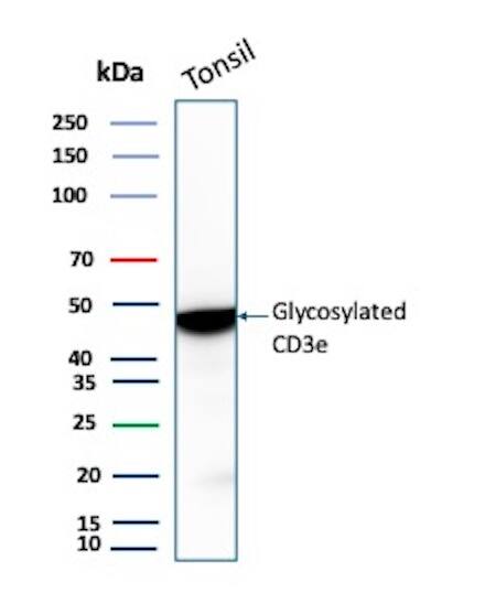 Western Blot Analysis of Human Tonsil tissue lysate using CD3 epsilon Antibody (rC3e/8881) - Azide and BSA Free.