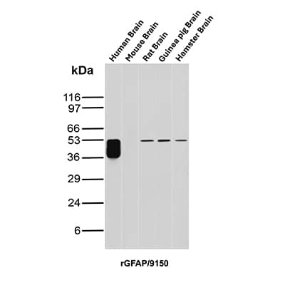 Western Blot Analysis of Human Brain, Mouse Brain, Rat Brain, Guinea Pig Brain and Hamster Brain tissue lysates using GFAP Antibody (rGFAP/9150) - Azide and BSA Free.