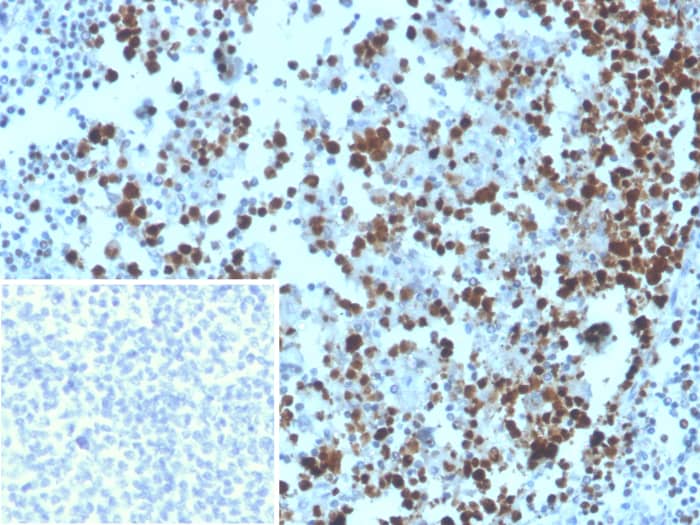 Formalin-fixed, paraffin-embedded human tonsil stained with MCM3 antibody (MCM3/3221) - Azide and BSA Free. Inset: PBS instead of primary antibody, secondary only control.