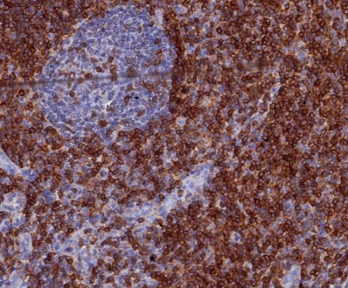 Immunohistochemistry-Paraffin: CD7 Antibody (CD7/3868R) - Azide and BSA Free [NBP3-24056] - Formalin-fixed, paraffin-embedded human tonsil stained with CD7 Antibody (CD7/3868R). HIER: Tris/EDTA, pH9.0, 45min. 2°C: HRP-polymer, 30min. DAB, 5min.