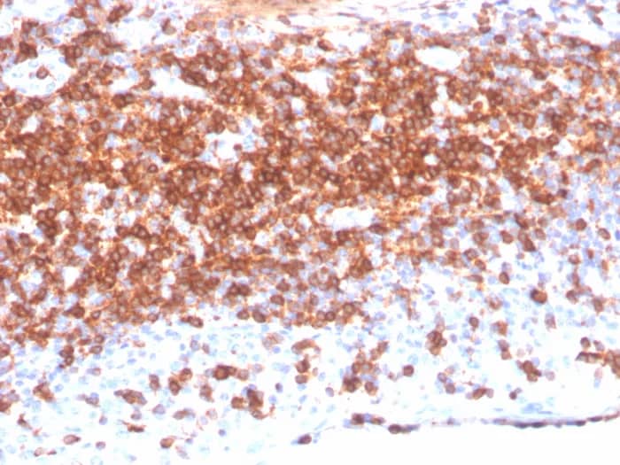 Immunohistochemistry-Paraffin: CD7 Antibody (CD7/3868R) - Azide and BSA Free [NBP3-24056] - Formalin-fixed, paraffin-embedded human lymph node stained with CD7 Antibody (CD7/3868R)