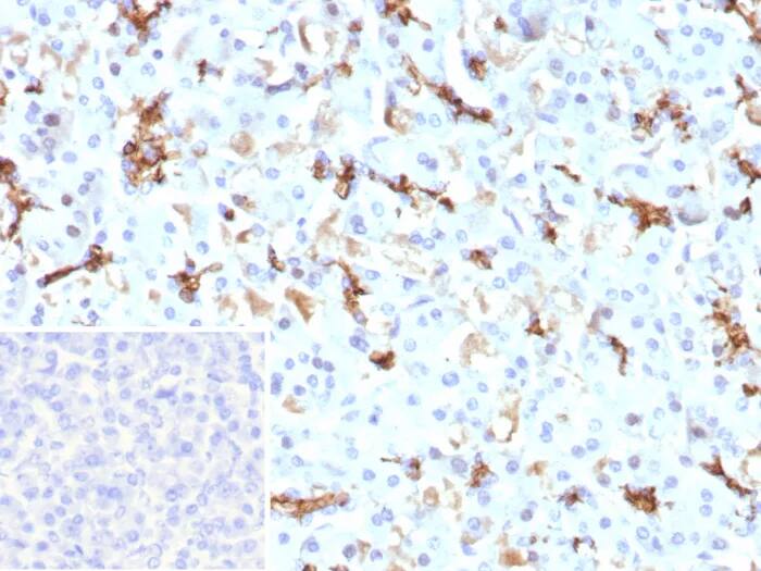 Immunohistochemistry-Paraffin: CFTR Antibody (CFTR/9148R) - Azide and BSA Free [NBP3-24057] - IHC analysis of formalin-fixed, paraffin-embedded human pancreas. CFTR Antibody (CFTR/9148R) at 2ug/ml. Inset: PBS instead of primary antibody; secondary only negative control.