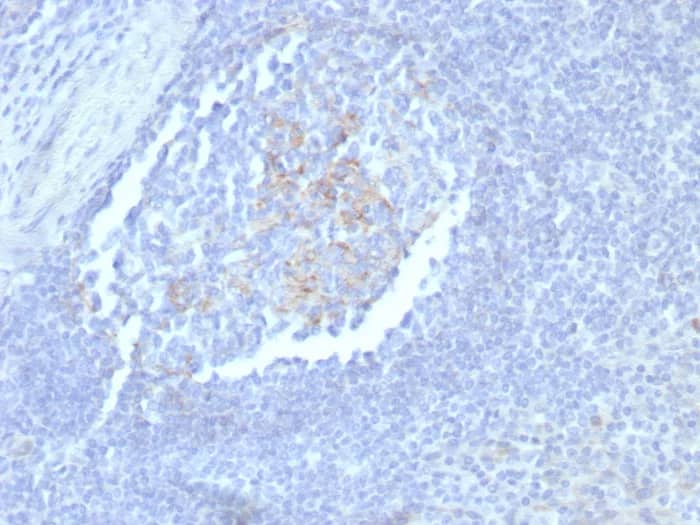 Immunohistochemistry-Paraffin: CD23/Fc epsilon RII Antibody (FCER2/8235R) - Azide and BSA Free [NBP3-24058] - Formalin-fixed, paraffin-embedded human tonsil stained with CD23/Fc epsilon RII Antibody (FCER2/8235R). HIER: Tris/EDTA, pH9.0, 45min. 2°C: HRP-polymer, 30min. DAB, 5min.