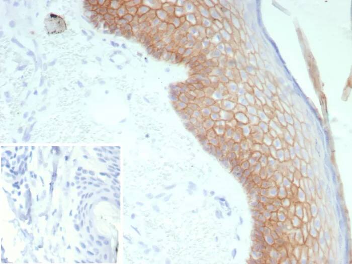 Immunohistochemistry-Paraffin: Desmoglein-3 Antibody (rDSG3/8611) - Azide and BSA Free [NBP3-24060] - Formalin-fixed, paraffin-embedded human skin stained with Desmoglein-3 Antibody (rDSG3/8611). Inset: PBS instead of primary antibody; secondary only negative control.