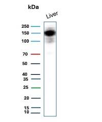 Western Blot Analysis of human liver tissue lysate using CPS1 Antibody (CPS1/9151R) - Azide and BSA Free.