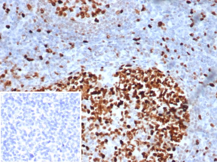 Formalin-fixed, paraffin-embedded human tonsil stained with MCM3 antibody (MCM3/6706) - Azide and BSA Free. Inset: PBS instead of primary antibody, secondary only control.