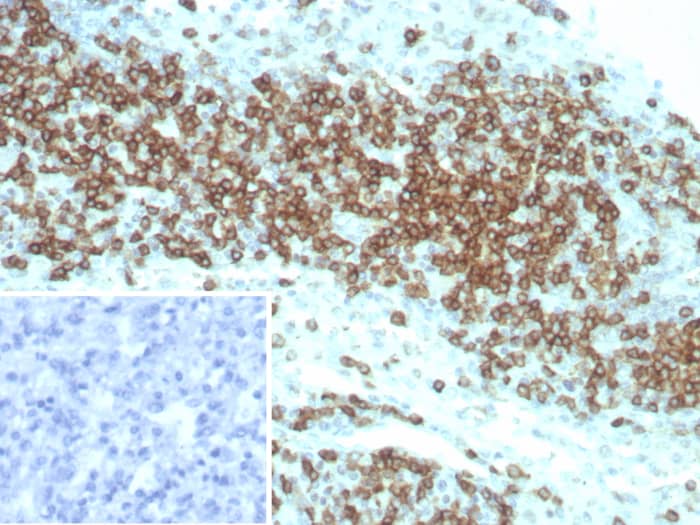 Formalin-fixed, paraffin-embedded human lymph node stained with CD2 antibody (LFA2/8845R) - Azide and BSA Free. HIER: Tris/EDTA, pH9.0, 45min. Secondary: HRP-polymer, 30min. DAB, 5min.