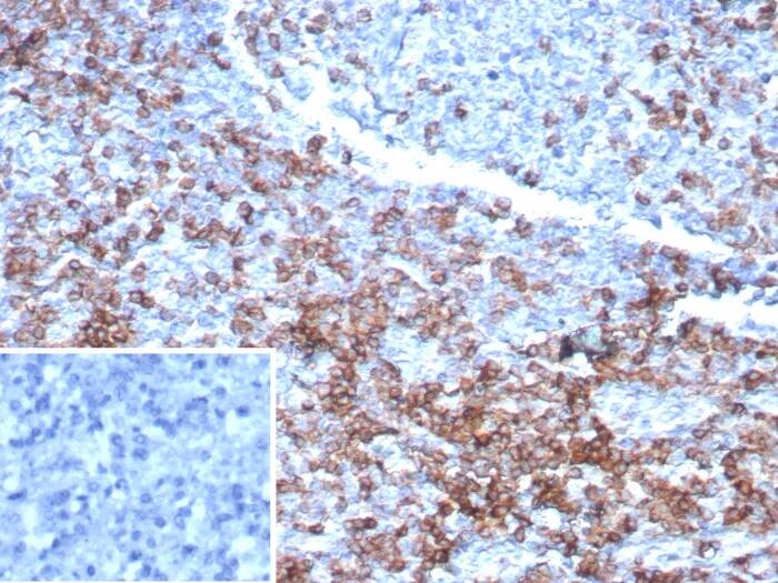 Immunohistochemistry-Paraffin: CD3 epsilon Antibody (rC3e/6967) - Azide and BSA Free [NBP3-24081] - Formalin-fixed, paraffin-embedded human lymph node stained with CD3 epsilon Antibody (rC3e/6967). Inset: PBS instead of primary antibody; secondary only negative control.