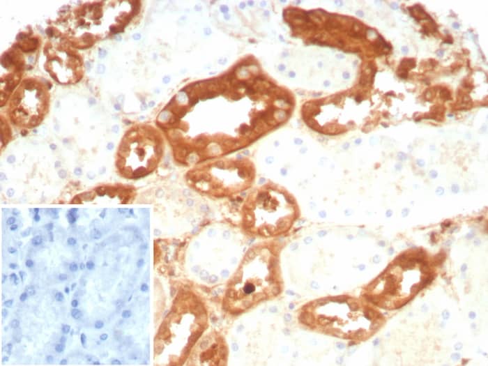 Formalin-fixed, paraffin-embedded human kidney stained with GSTM3 antibody (rGSTM3/8878) - Azide and BSA Free. Inset: PBS instead of primary antibody; secondary only negative control.