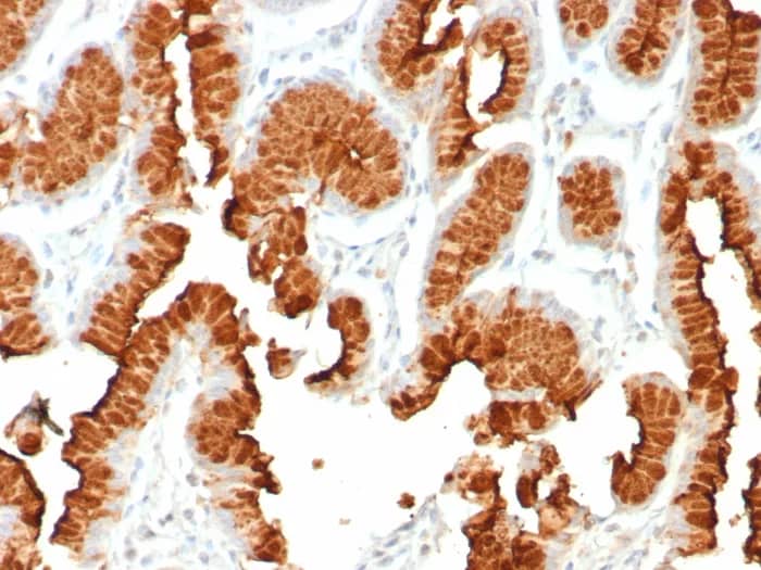 Immunohistochemistry-Paraffin: MUC5AC Antibody (rMUC5AC/8052) - Azide and BSA Free [NBP3-24092] - Formalin-fixed, paraffin-embedded human stomach stained with MUC5AC Antibody (rMUC5AC/8052)at 2ug/ml. HIER: Tris/EDTA, pH9.0, 45min. 2°C: HRP-polymer, 30min. DAB, 5min.