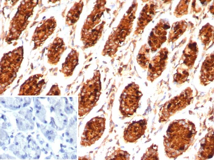 Immunohistochemistry-Paraffin: MUC5AC Antibody (MUC5AC/7798R) - Azide and BSA Free [NBP3-24093] - IHC analysis of formalin-fixed, paraffin-embedded human stomach. MUC5AC Antibody (MUC5AC/7798R). Inset: PBS instead of primary antibody; secondary only negative control.