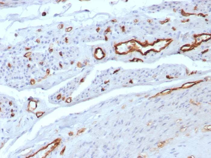 Immunohistochemistry-Paraffin: CD31/PECAM-1 Antibody (C31/8592R) - Azide and BSA Free [NBP3-24094] - Formalin-fixed, paraffin-embedded human uterus stained with CD31/PECAM-1 Antibody (C31/8592R). HIER: Tris/EDTA, pH9.0, 45min. 2°C: HRP-polymer, 30min. DAB, 5min.