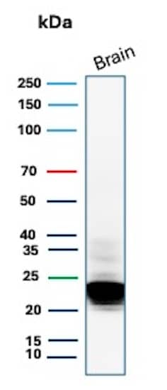 Western Blot Analysis of human brain tissue lysate using MBP Antibody (rMBP/9301) - Azide and BSA Free. 