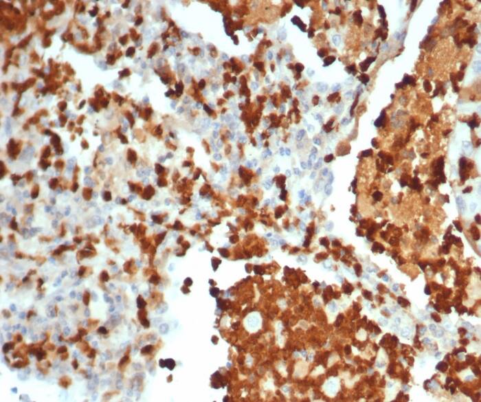 Formalin-fixed, paraffin-embedded human lung stained with S100G antibody (S100G/7462) - Azide and BSA Free. HIER: Tris/EDTA, pH9.0, 45min. Secondary: HRP-polymer, 30min. DAB, 5min.