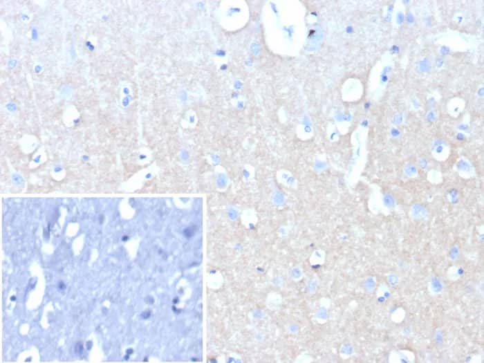 Immunohistochemistry-Paraffin: L1CAM Antibody (L1CAM/9146R) - Azide and BSA Free [NBP3-24102] - Formalin-fixed, paraffin-embedded human brain stained with L1CAM Antibody (L1CAM/9146R). Inset: PBS instead of primary antibody; secondary only negative control.