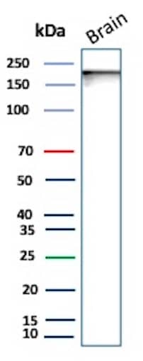 Western Blot Analysis of Human Brain lysate using L1CAM Antibody (L1CAM/9146R) - Azide and BSA Free