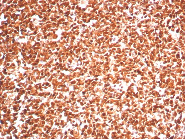 Formalin-fixed, paraffin-embedded human tonsil stained with PCNA antibody (PCNA/8303R) - Azide and BSA Free. HIER: Tris/EDTA, pH9.0, 45min. Secondary: HRP-polymer, 30min. DAB, 5min.