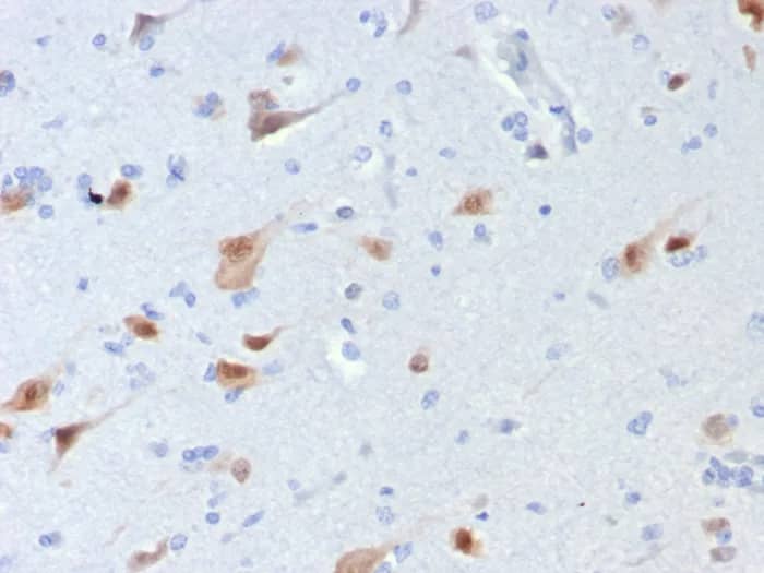 Immunohistochemistry-Paraffin: RBFOX3/NeuN Antibody (rNEUN/8054) - Azide and BSA Free [NBP3-24105] - Formalin-fixed, paraffin-embedded human brain stained with RBFOX3/NeuN Antibody (rNEUN/8054). HIER: Tris/EDTA, pH9.0, 45min. 2°C: HRP-polymer, 30min. DAB, 5min.