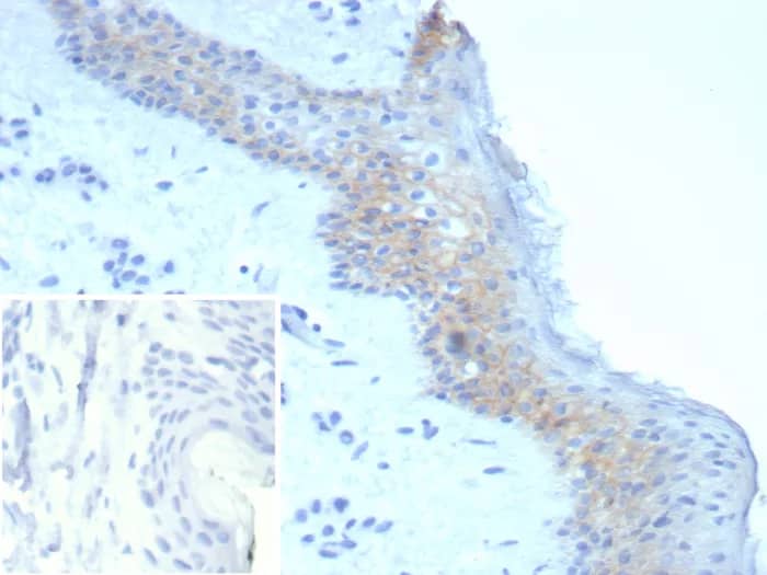 Immunohistochemistry-Paraffin: Desmoglein-3 Antibody (DSG3/8251R) - Azide and BSA Free [NBP3-24109] - Formalin-fixed, paraffin-embedded human skin stained with Desmoglein-3 Antibody (DSG3/8251R). Inset: PBS instead of primary antibody; secondary only negative control.