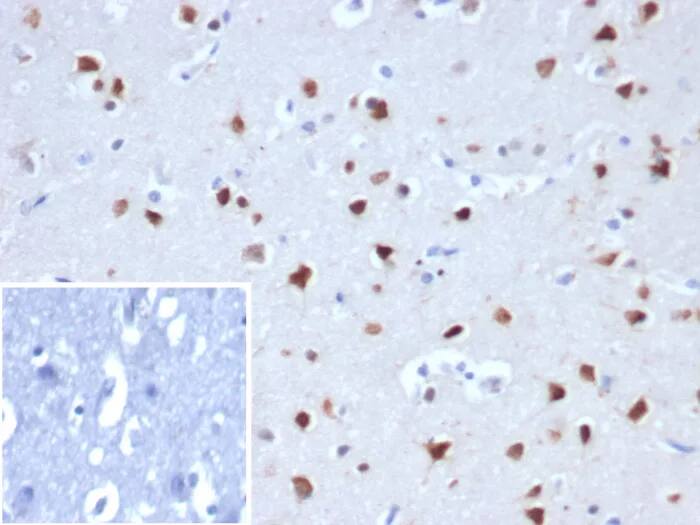 Immunohistochemistry-Paraffin: RBFOX3/NeuN Antibody (NEUN/8096R) - Azide and BSA Free [NBP3-24116] - Formalin-fixed, paraffin-embedded human cerebellum stained with RBFOX3/NeuN Antibody (NEUN/8096R). Inset: PBS instead of primary antibody; secondary only negative control.